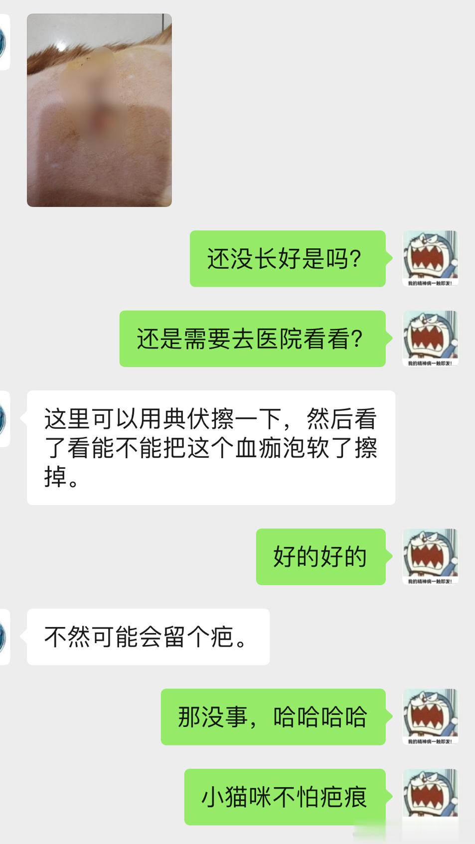 打工猴猴，不怕疤痕[笑cry] ​​​