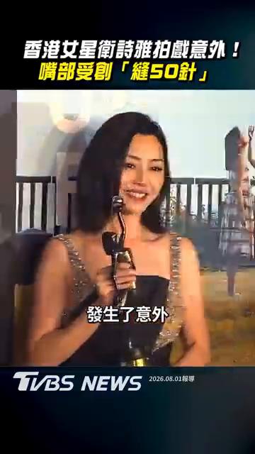 香港女星卫诗雅拍戏意外，嘴部受创缝50针。
今年才刚拿下金像奖最佳女配角的香港女