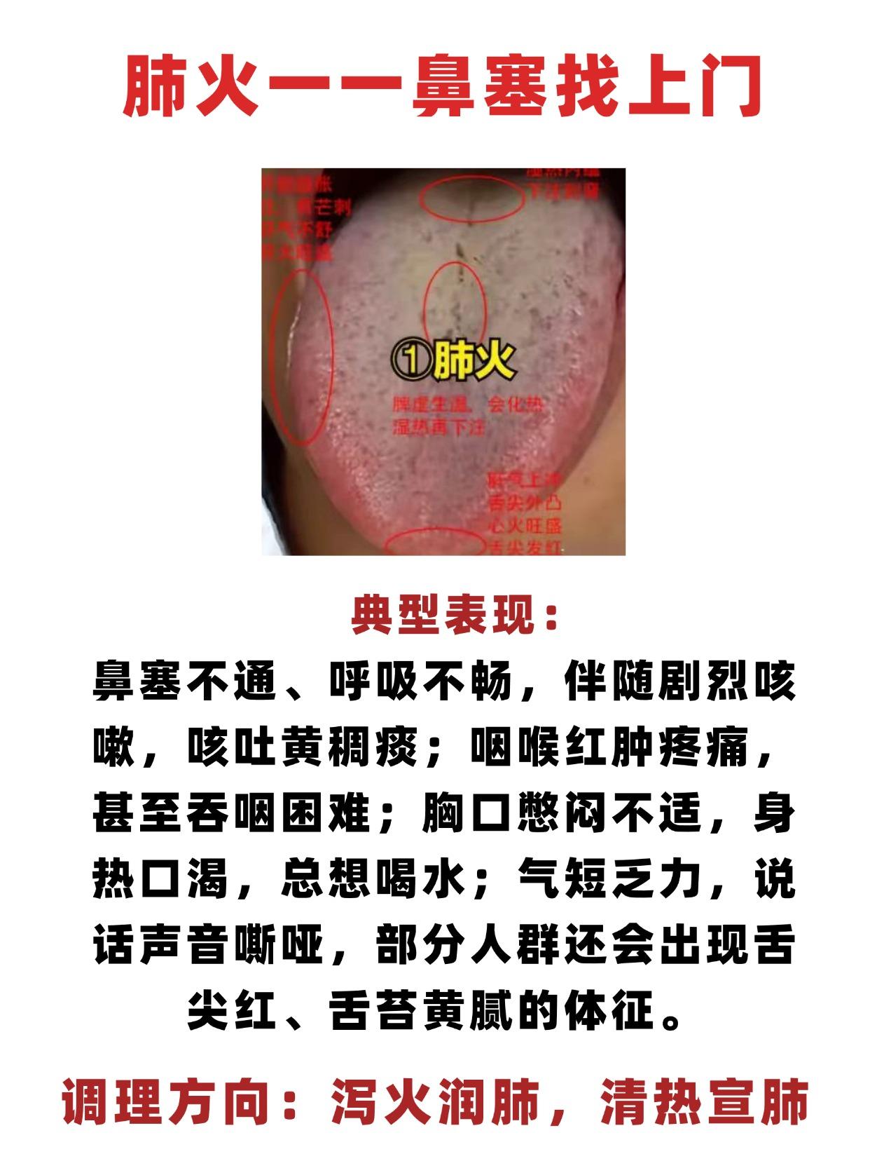 五脏上火各有信号：肺火鼻塞、肝火耳鸣、心火失眠、胃火口臭、肾火怕热

①肺火一一