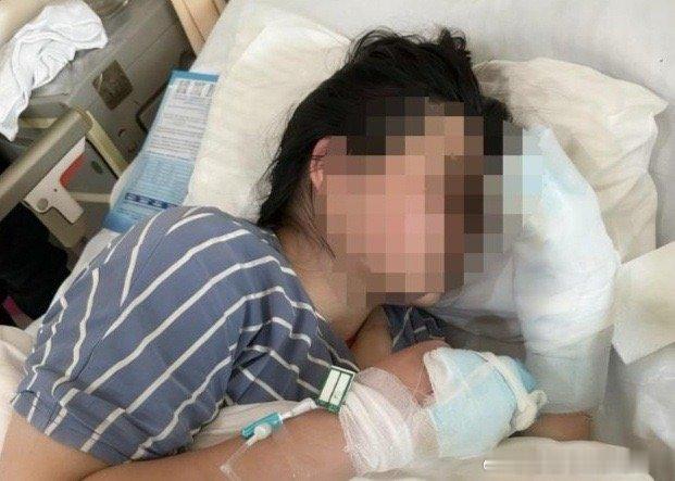 阎肃观察肃言肃语 【女大学生东北冻伤三根手指父亲发声：因冻伤严重已出现发黑症状，