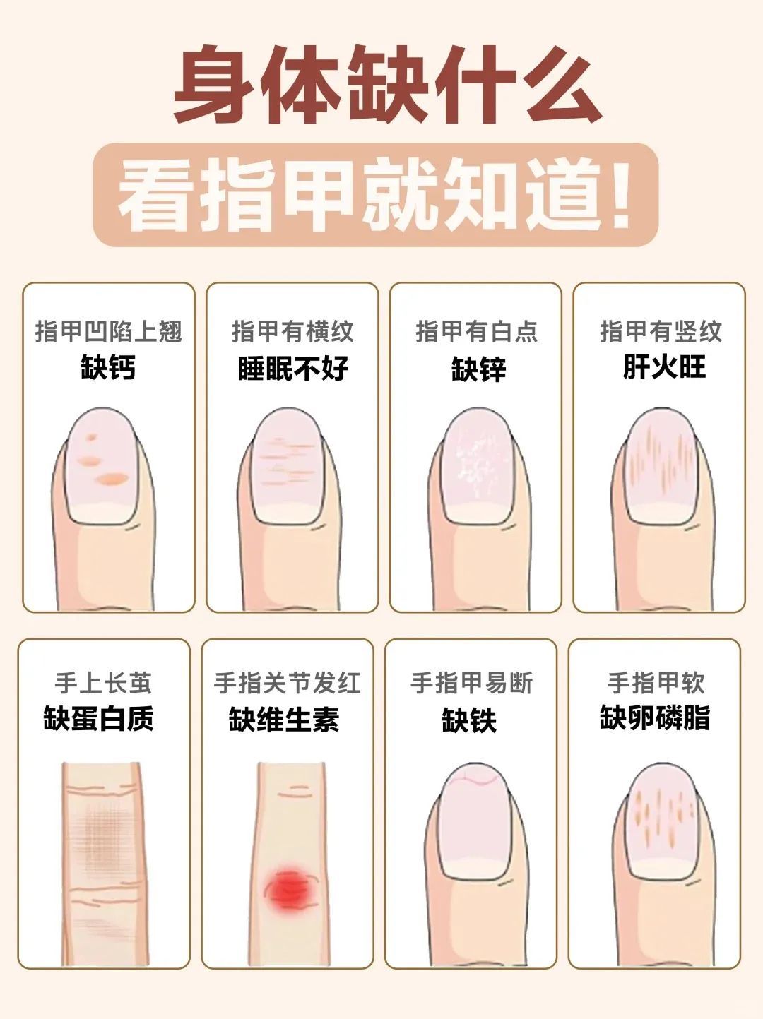 生活冷知识  指甲小秘密💅：揭秘健康警报信号！你们知道吗？指甲不仅是我们美丽的