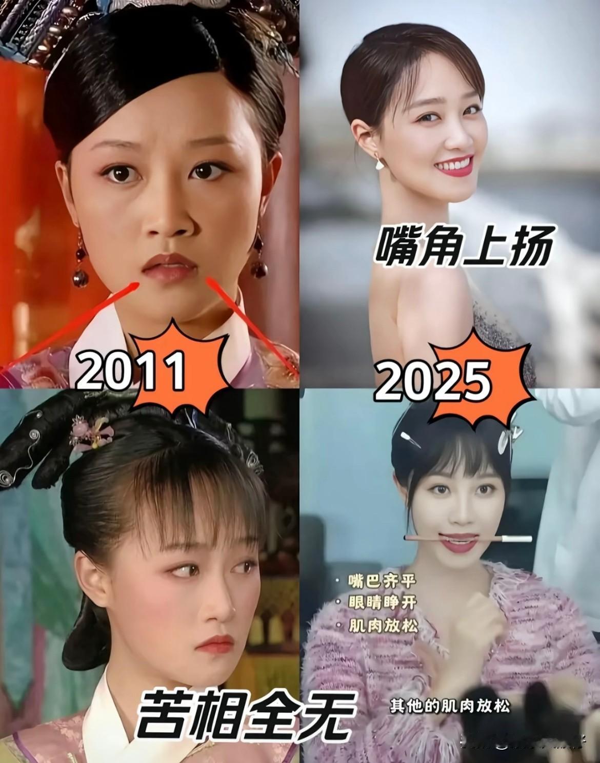 蓝盈莹的苦相脸竟然靠咬筷子6年，硬生生掰回来了。如今她直播教网友咬筷子改变面相：