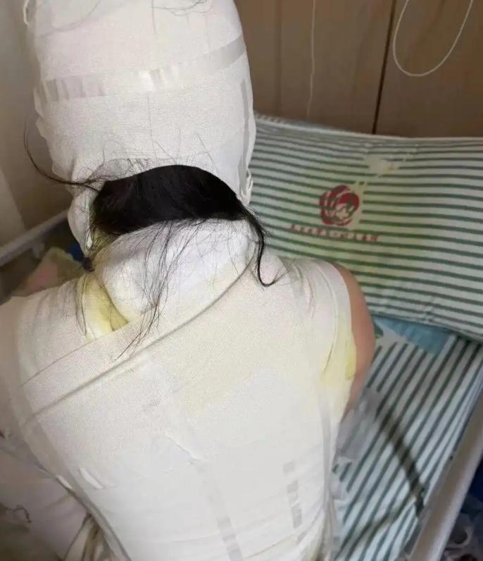 “悲剧还是发生了！” 9月7日报道，江西，一女子为了放松，去足浴店拔火罐，女技师