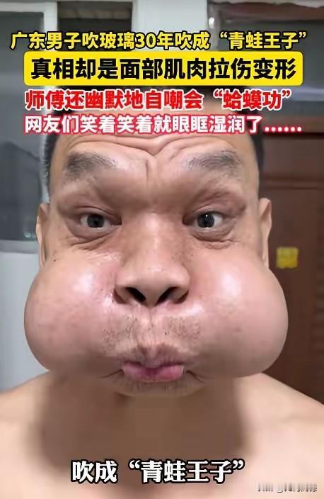 以前在电视上看到这些吹玻璃的工作者，当时还觉得很神奇，现在才明白，从医学的角度讲