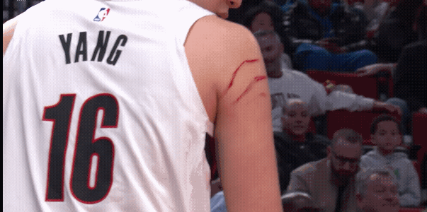 杨瀚森打的也是有点辛苦了，看看胳膊上这些血印子，就知道虽然他只是一个替补，但是也