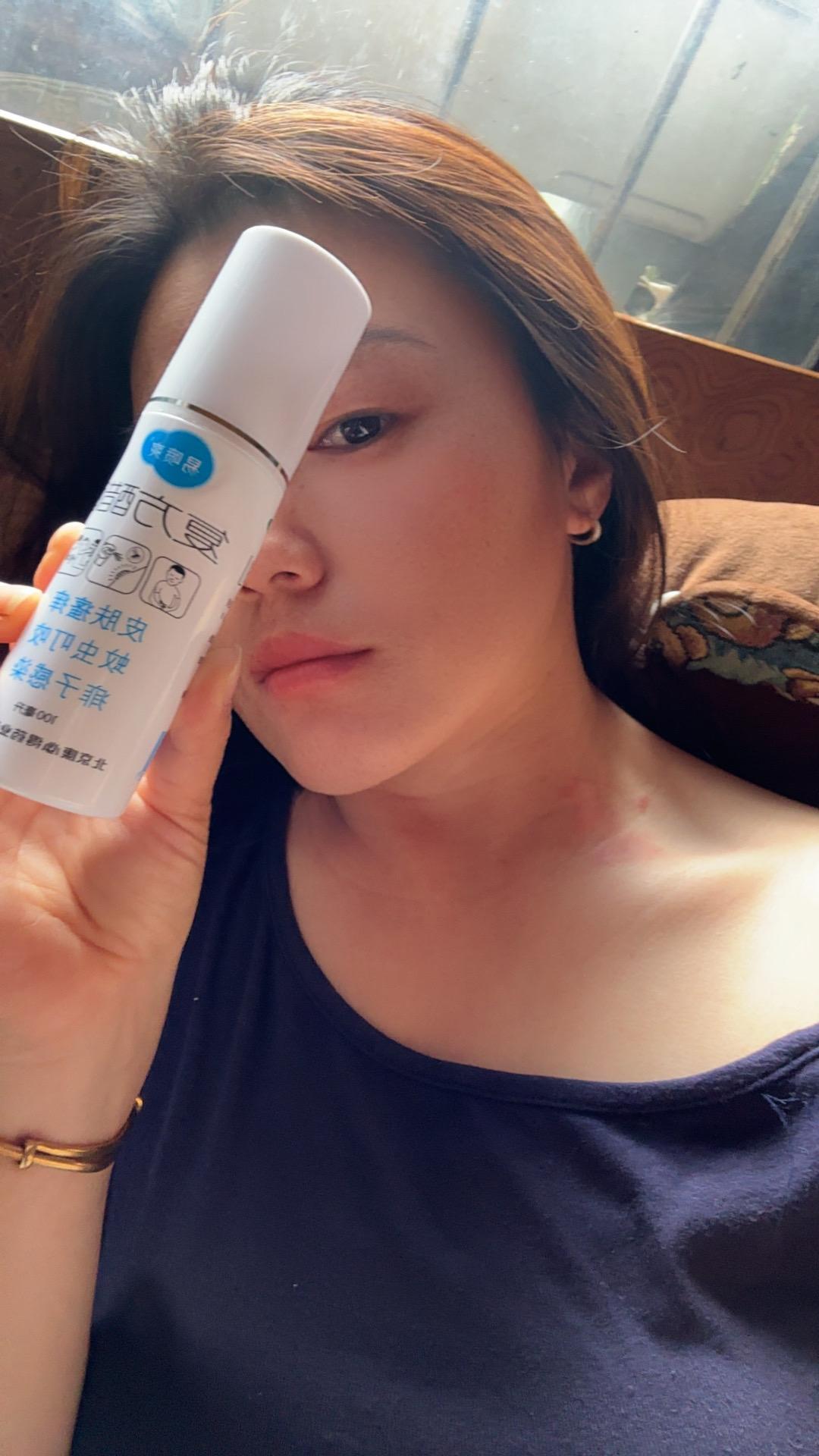 脖子被什么东西咬了，然后在内衣里发现一只虫子，屁股是红的，吓死我了，不...