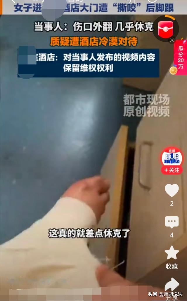 河北廊坊，酒店门口，女子左脚踏入大厅，回弹大门突然闭合，门缝夹住右脚后跟，皮肉撕