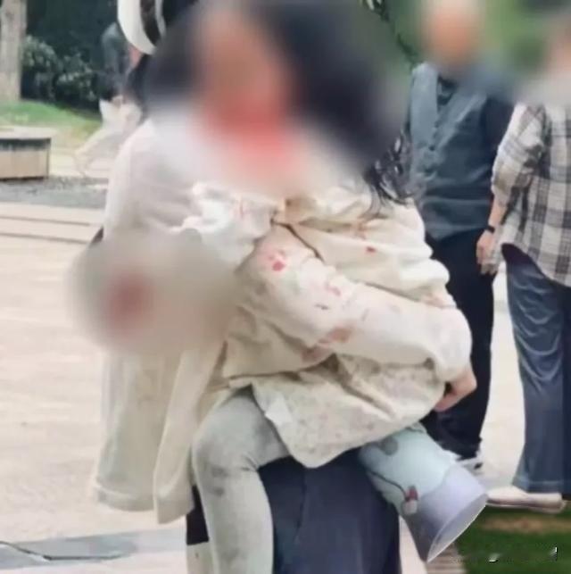 可恶的女人 ，遛这种很多城市禁养的大型烈犬都不拴绳，造成血淋淋的严重后果。是谁给