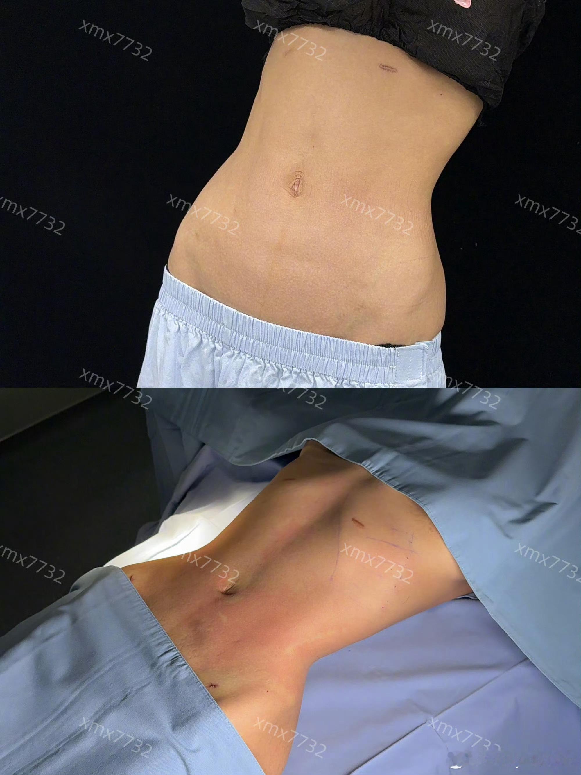韩安冉 极端医美说实在我真的觉得挺美的……如果她愿意为这个承受痛苦，是她的自由啦