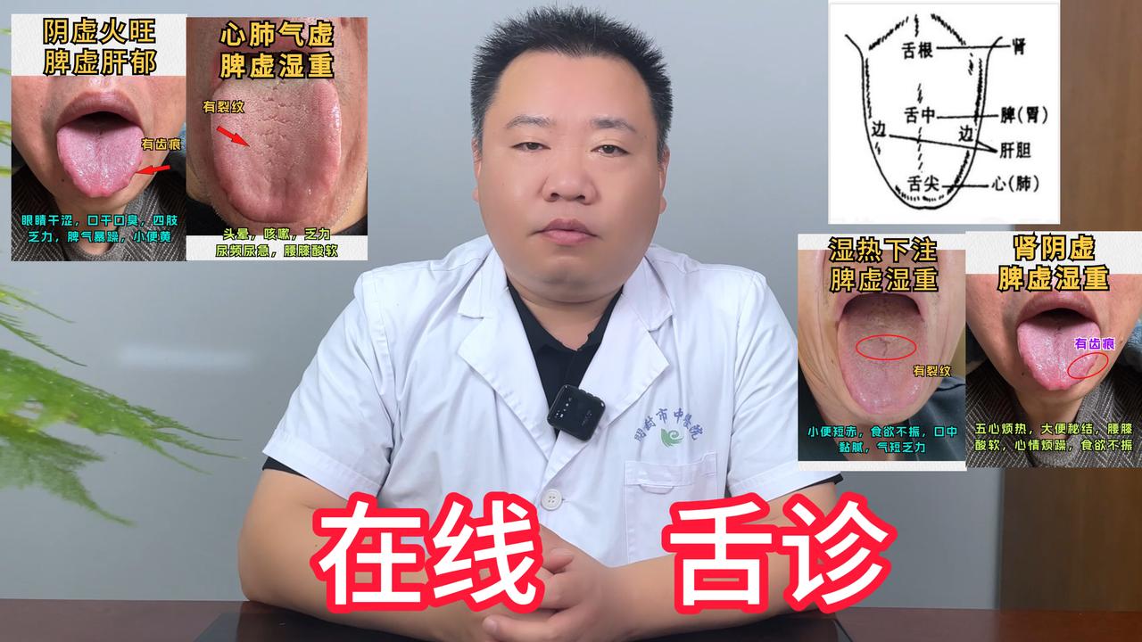 大家好！我是武医生 免费帮粉丝看舌头，今天线上舌诊第6天[呲牙]
昨天坐诊忙，所