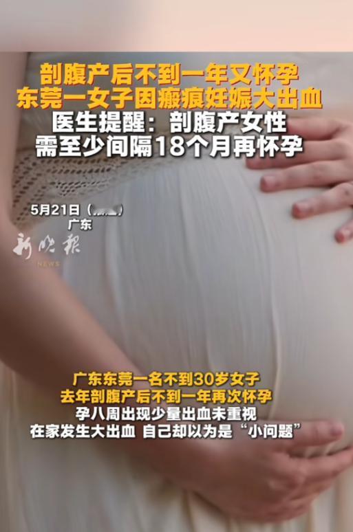 5月21日，广东一则高危孕产事件引发全网热议，不少网友直呼惊险万分。

当地一名