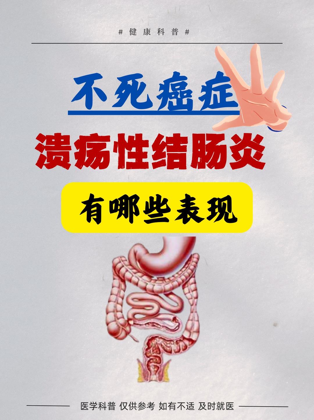 溃疡性结肠炎 炎症性肠病 中医顾思臻 顾思臻