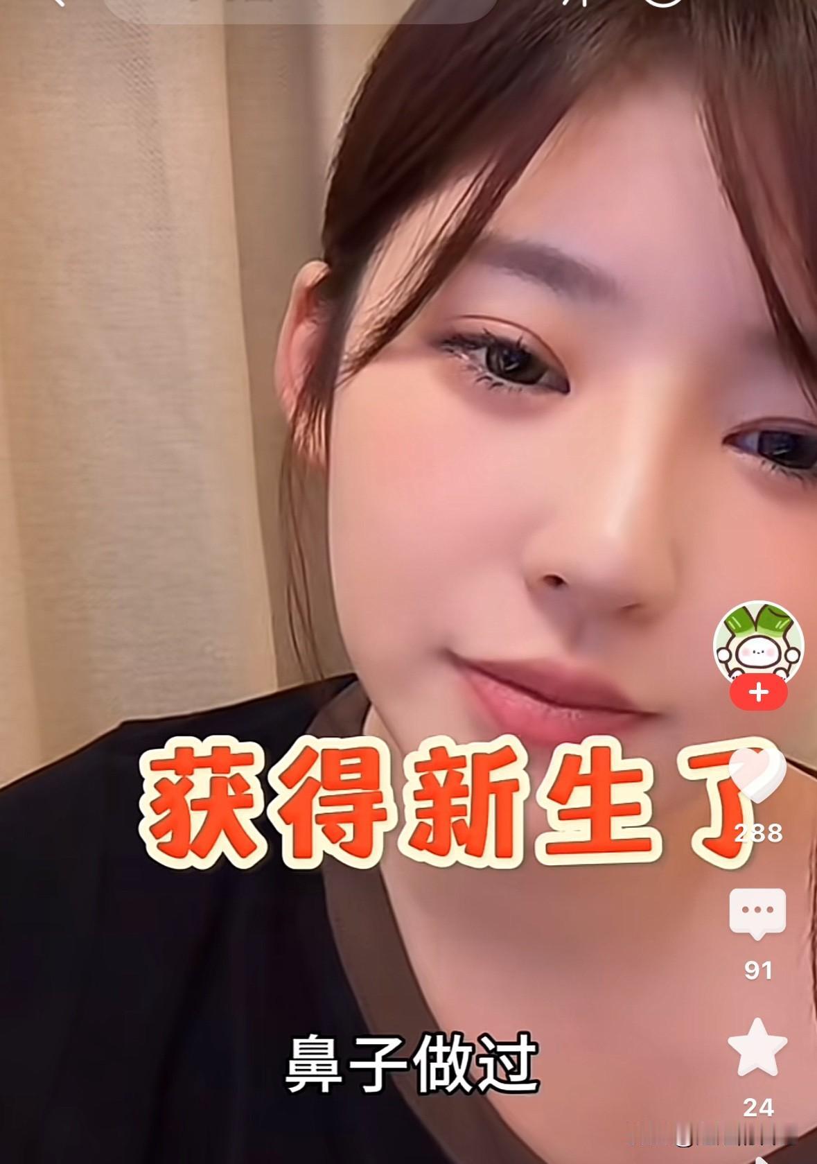 黄一鸣承认，我的脸都动过，所以也改变了我得一生。
她说，“我的鼻子是最成功的，其