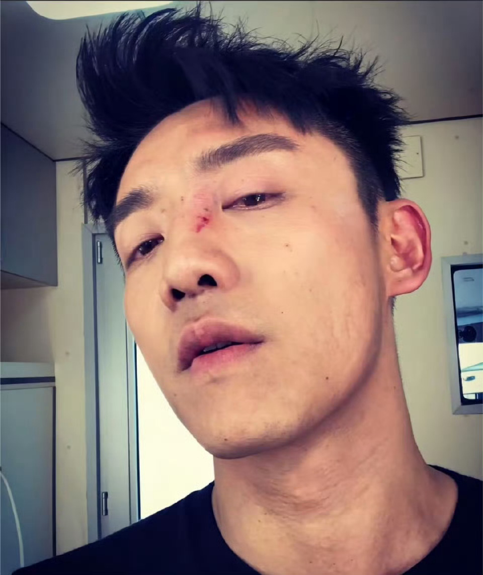 陪伴跑男十二年的郑恺允许郑恺不舒服陪伴跑男十二年的郑恺，允许郑恺不舒服，谁敢想象