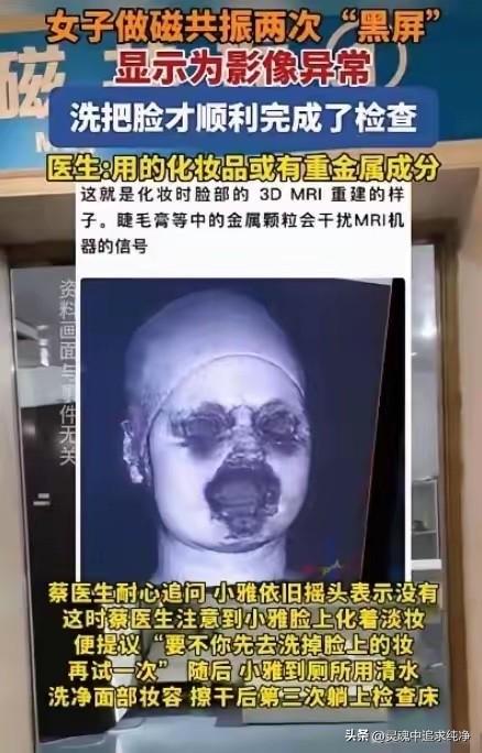 解释不清了！福建一29岁女生头晕，去医院做头颅磁共振。不料，连续2次扫描，都因面