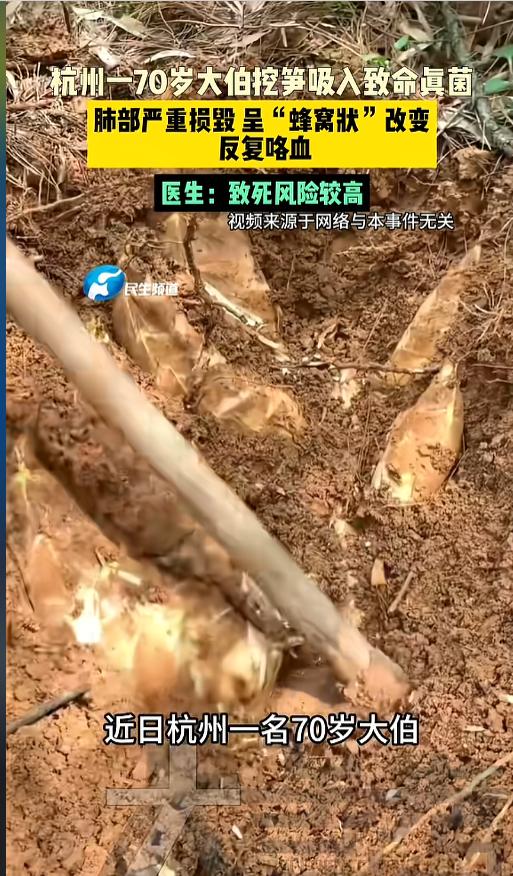 “悲剧还是发生了！”近日，浙江杭州，一老伯频繁上山挖笋，不想回来后竟然开始咳血，