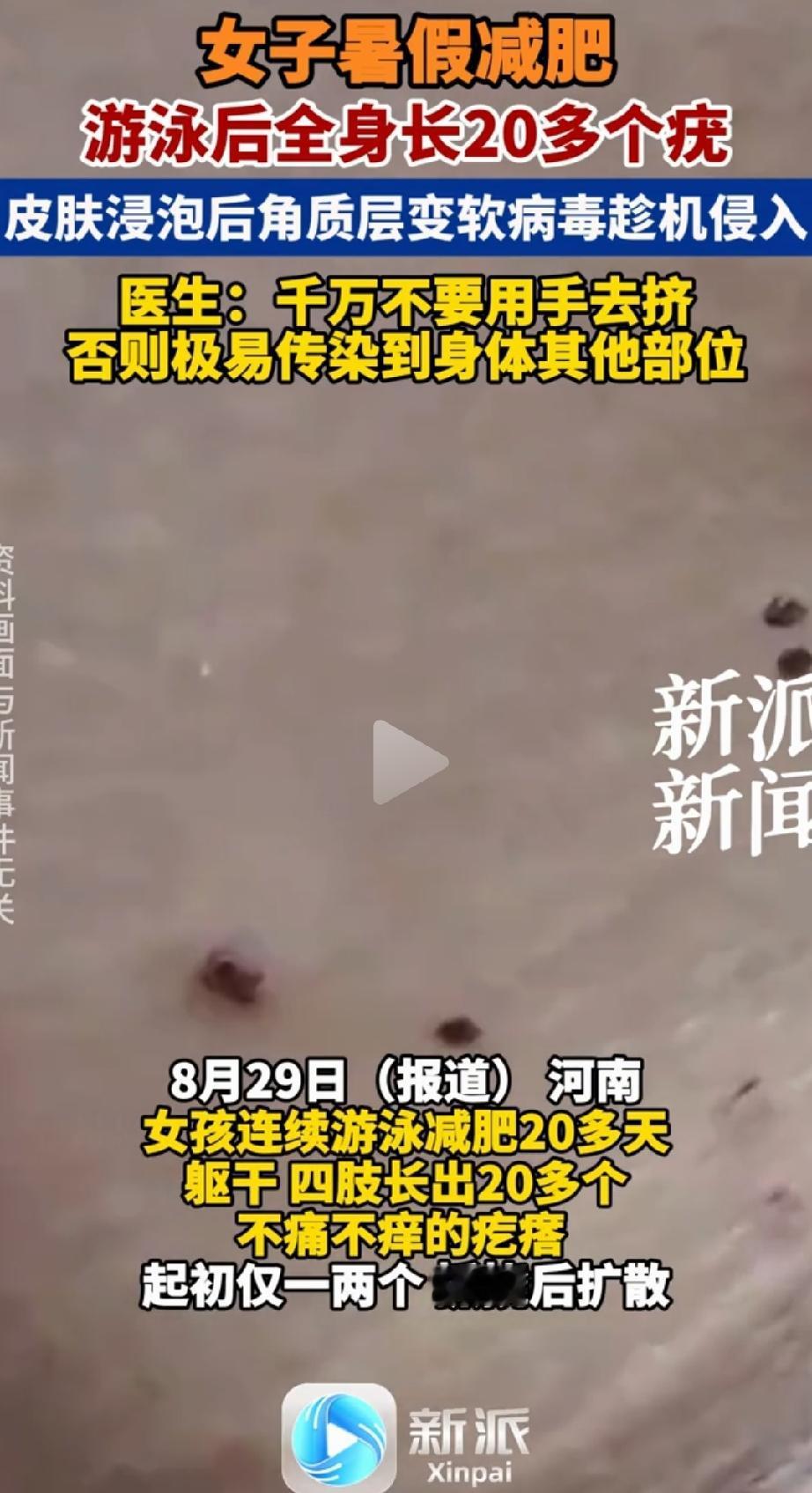 “惊出冷汗！”河南，一女孩暑假想靠游泳减肥，坚持了20多天。游的时候啥感觉没有，