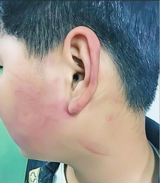 2019年，四川一名校长，因学生调皮，扇了他几巴掌，被孩子母亲逼着赔礼道歉。不料