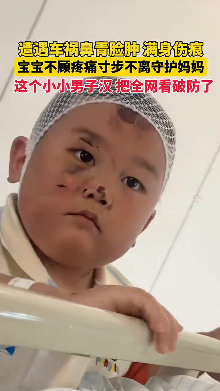 遭遇车祸鼻青脸肿满身伤痕，宝宝不顾疼痛寸步不离守护妈妈，这个小小男子汉把全网看破