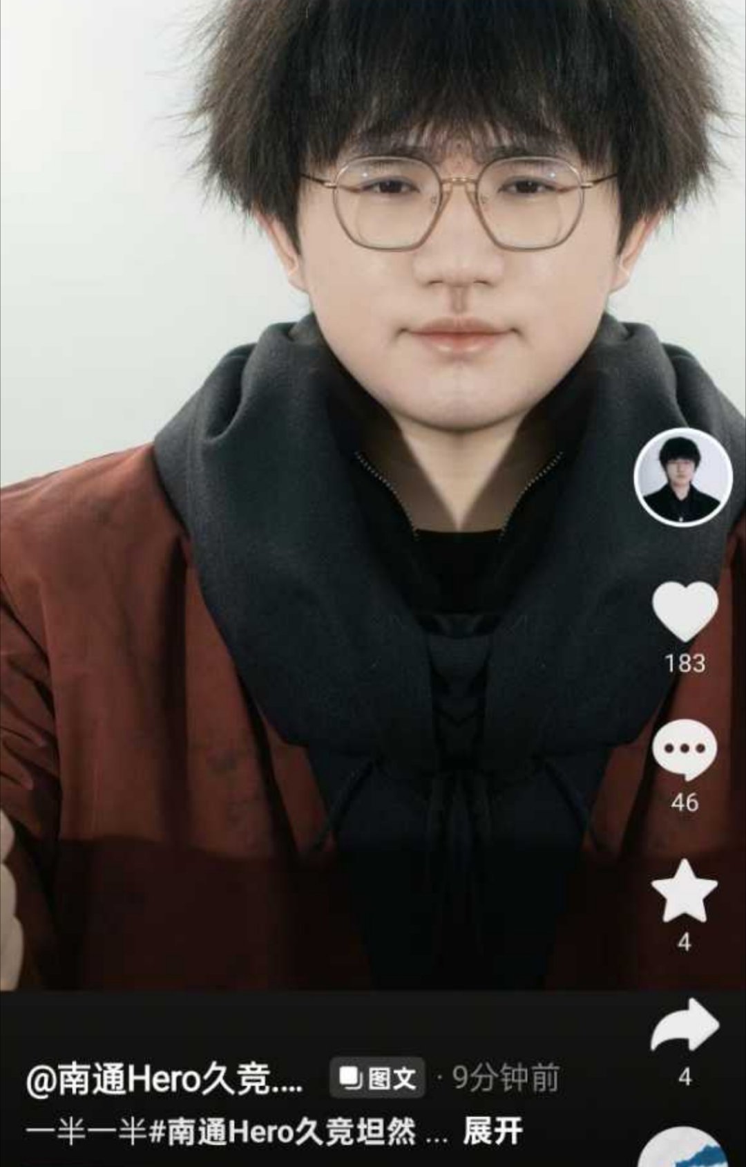 瓜友速报 你是坦然，还是忐忑 