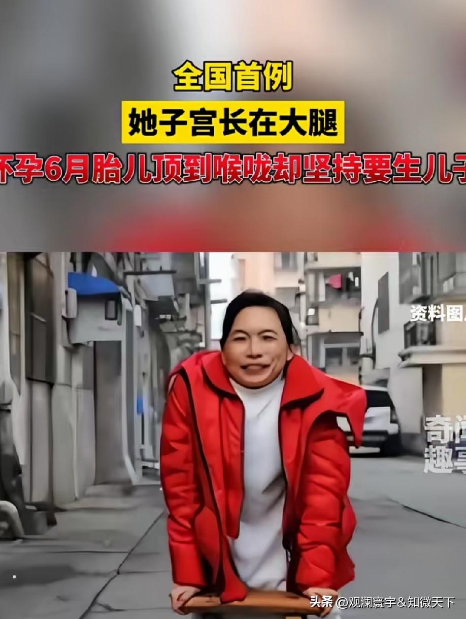 子宫长在大腿怎么还能顶到喉咙，这娃是个子太高，穿破子宫了吗[what]