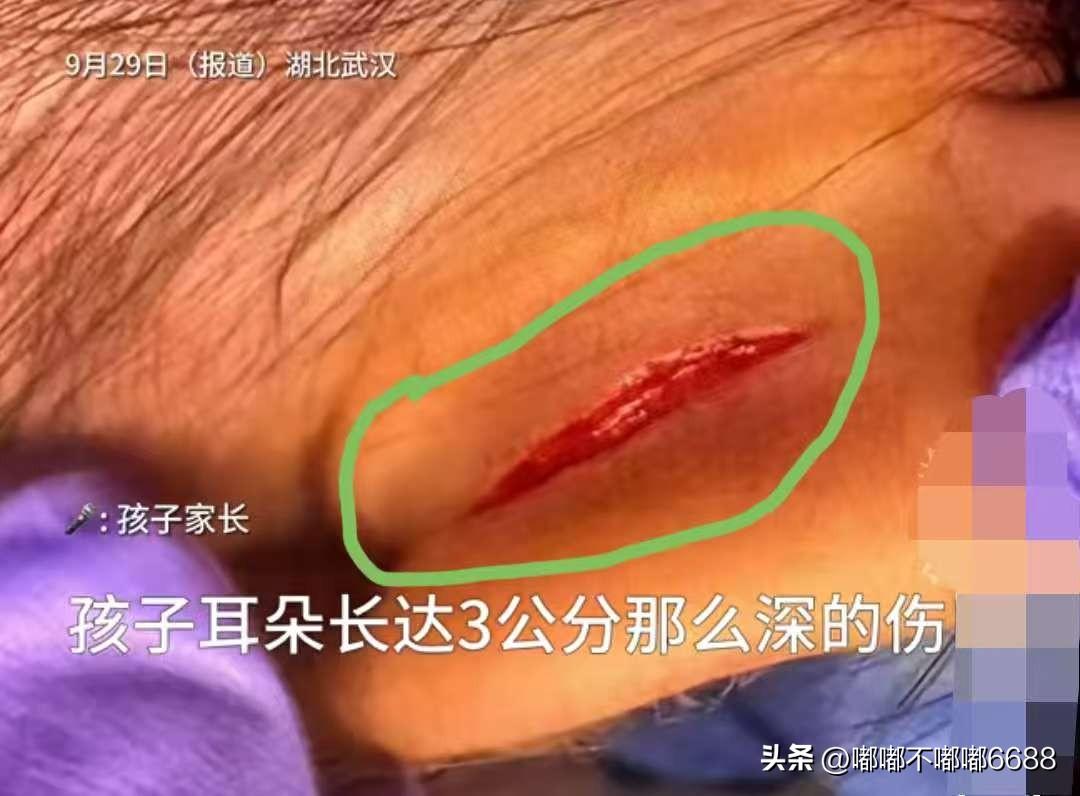 你说这事巧不巧？
偏偏就是受伤女孩的教室监控坏了，
大家相信这是意外坏的吗？
