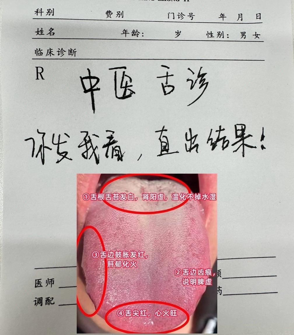 中诊，拍舌诊，现场分析#舌苔辨证 #医学科普