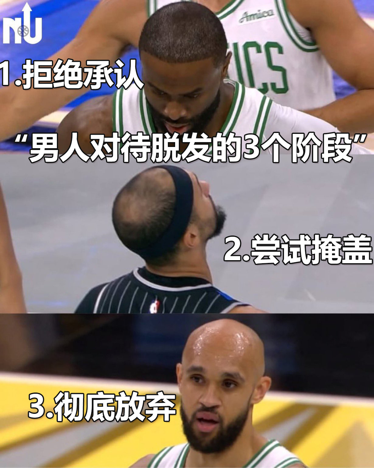 这三个球员代表了男人脱发的三个阶段：