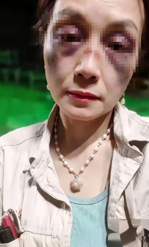 和同事加班太晚了，出去吃饭， 结果被同事的妻子一顿暴打。这叫什么事？白天给单位当