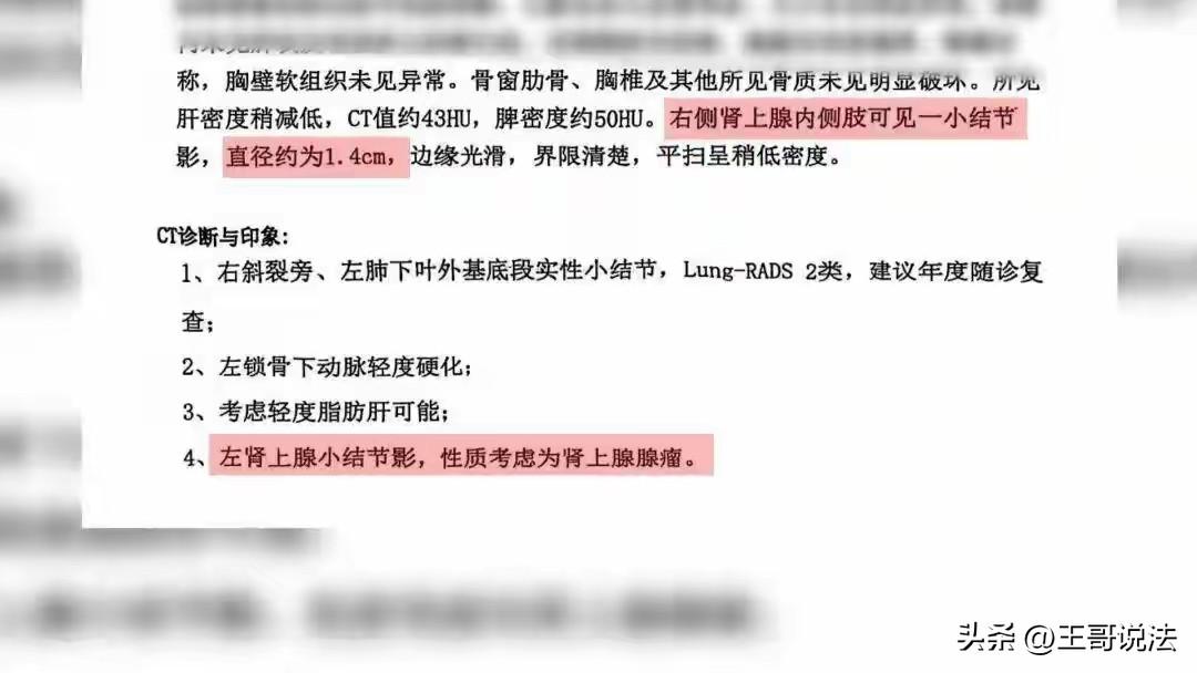 “好可怕！差点被手术了！”广东广州，一女子去医院体检，CT报告上显示，右肾有1.