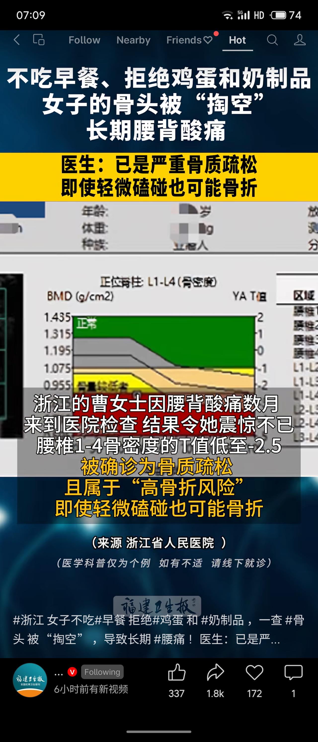 浙江一位互联网公司工作的曹女士，因长期不吃早餐、拒绝鸡蛋与奶制品，导致骨密度严重