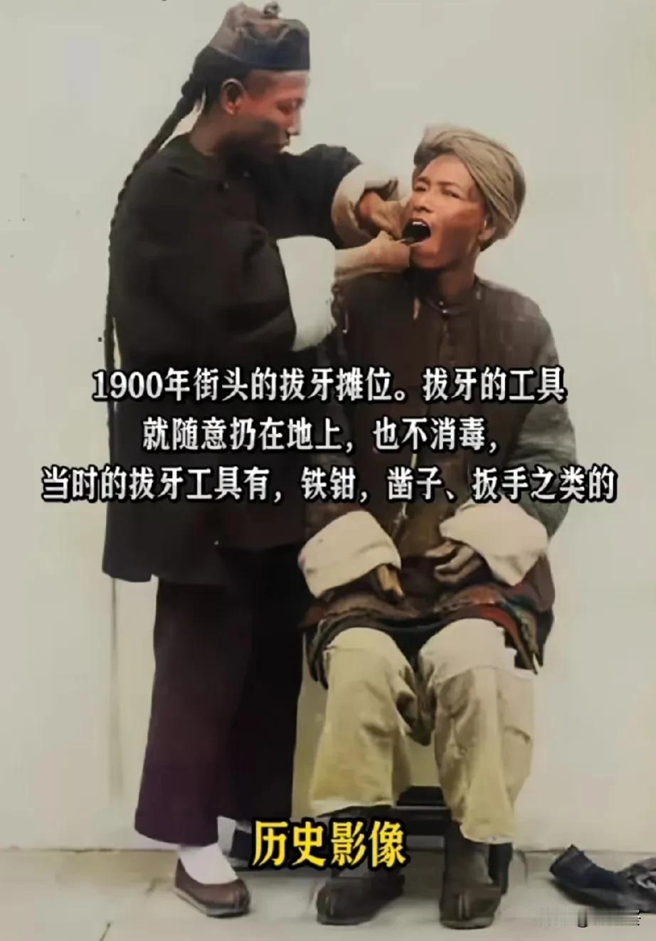 看着就疼！
一张百年前法国人拍下的清朝真实老照片
1900年，一位平民在街头拔牙