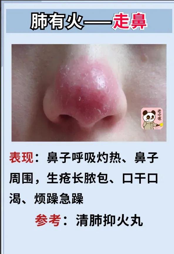 你是否经常感到身体某个部位不适？可能是五脏上火了！五脏各有五种火，表现各不同。别
