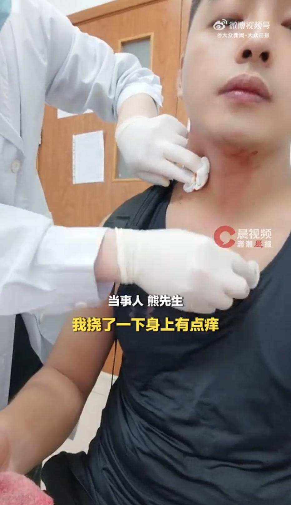 上海，一男子健完身，准备在路边打车回家时，不小心被蚊子在脖子上叮咬了一口，男子没