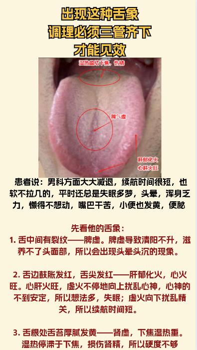 出现这种舌象，调理必须三方面入手才见效