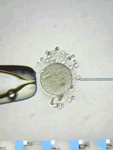 见证试管婴儿的全过程～