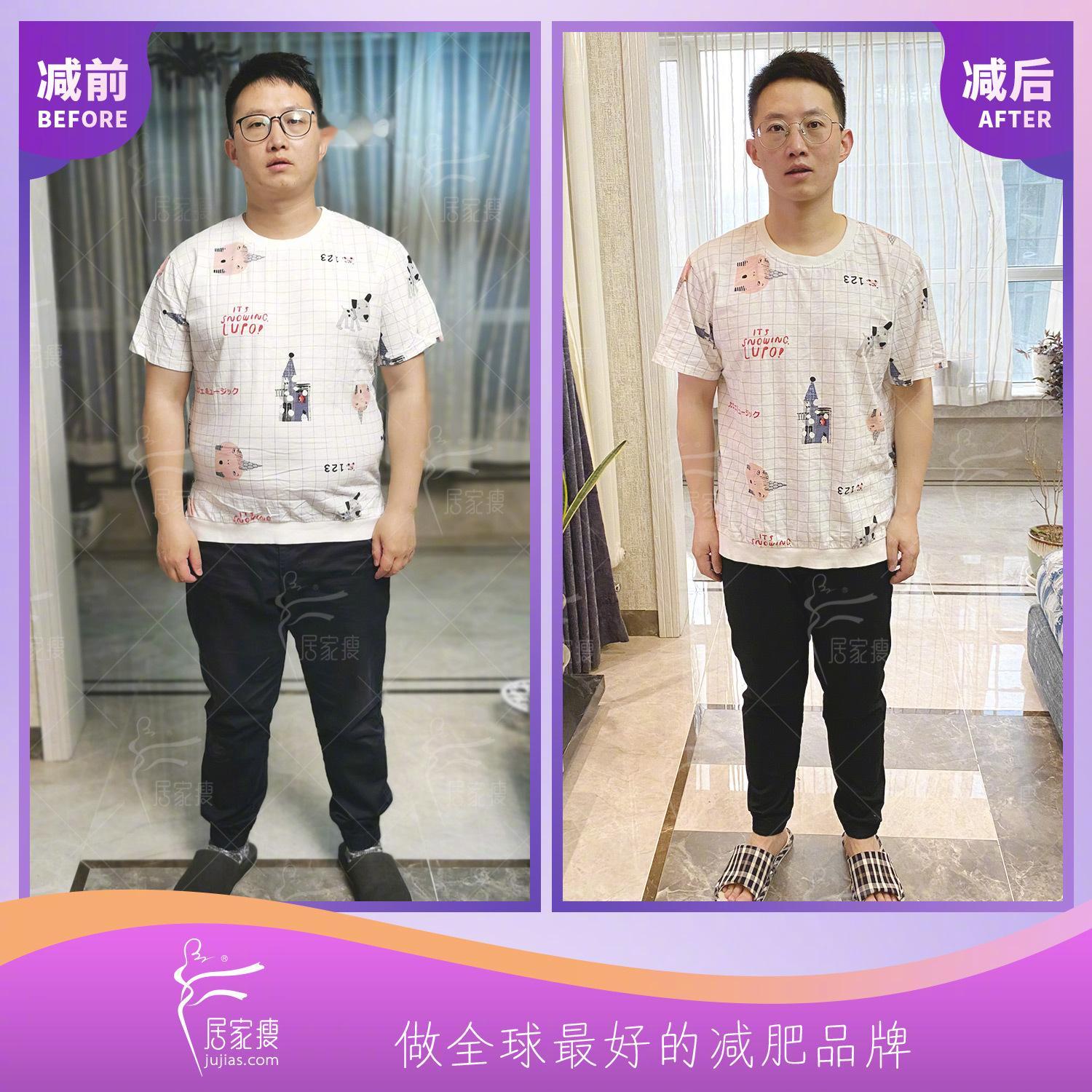 31岁，42.4斤，看看他的肚腩。男士有大肚子真的要注意 