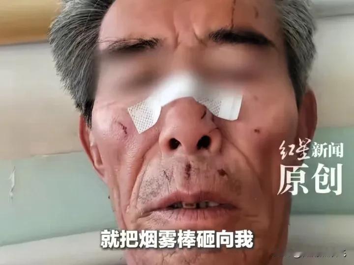 内蒙古环卫工人被打事件中的十几个参与动手的打人者，估计现在都没脸出门了。

他们