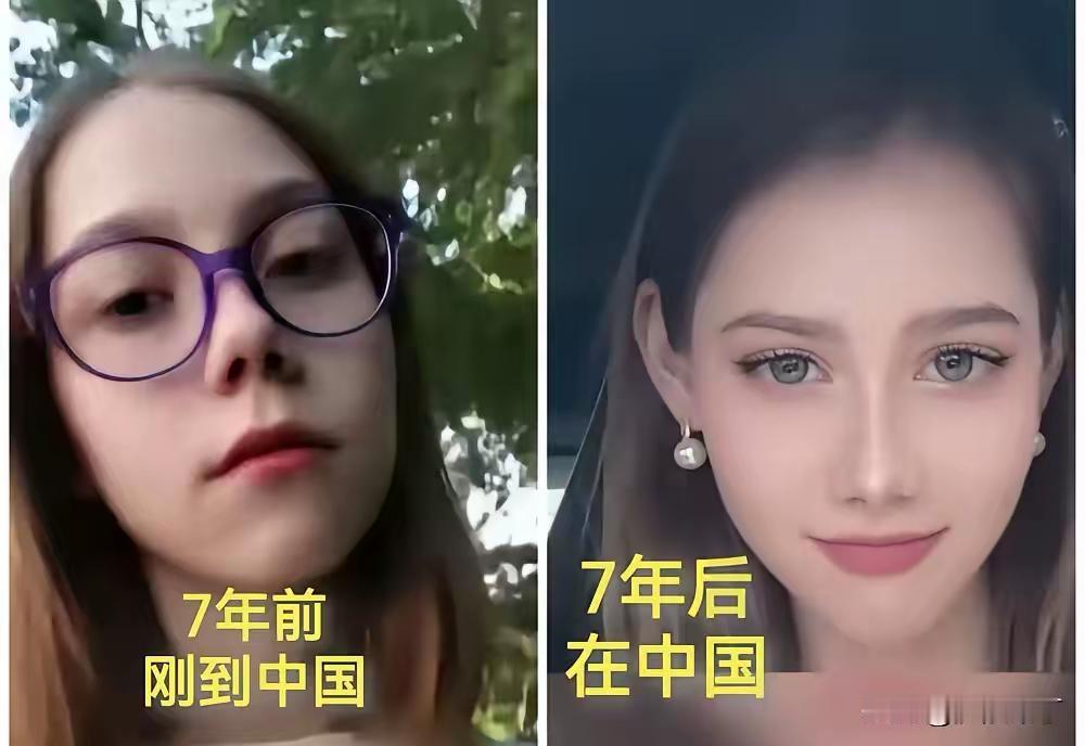 看到这位外国美女来中国七年后的外貌变化，真是太惊喜了！从对比图能明显看出，她摘掉