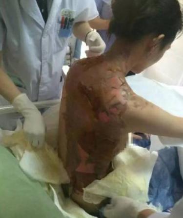 “这就是嘴欠的下场”！2015年浙江一女子在火锅店要求加汤，因店里客人繁忙，服务