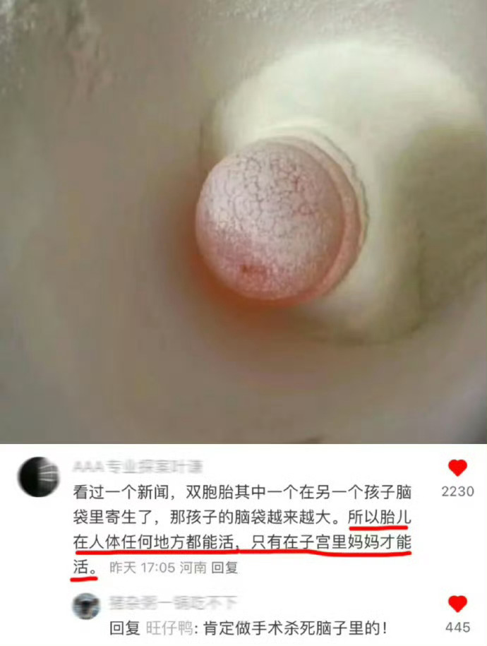 我天...瞬间对生育真相肃然起敬.... 