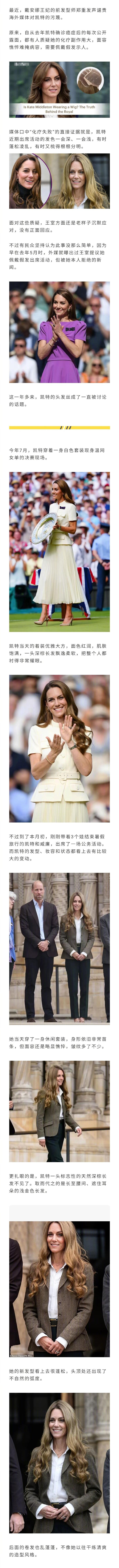 英国王室的“顶流”——凯特王妃近期出席活动被质疑佩戴假发，用以掩盖化疗的副作用.