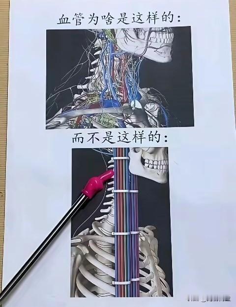 这张对比图看得人会心一笑，也戳中了很多人的疑惑：为什么人体血管不能像线束一样，整