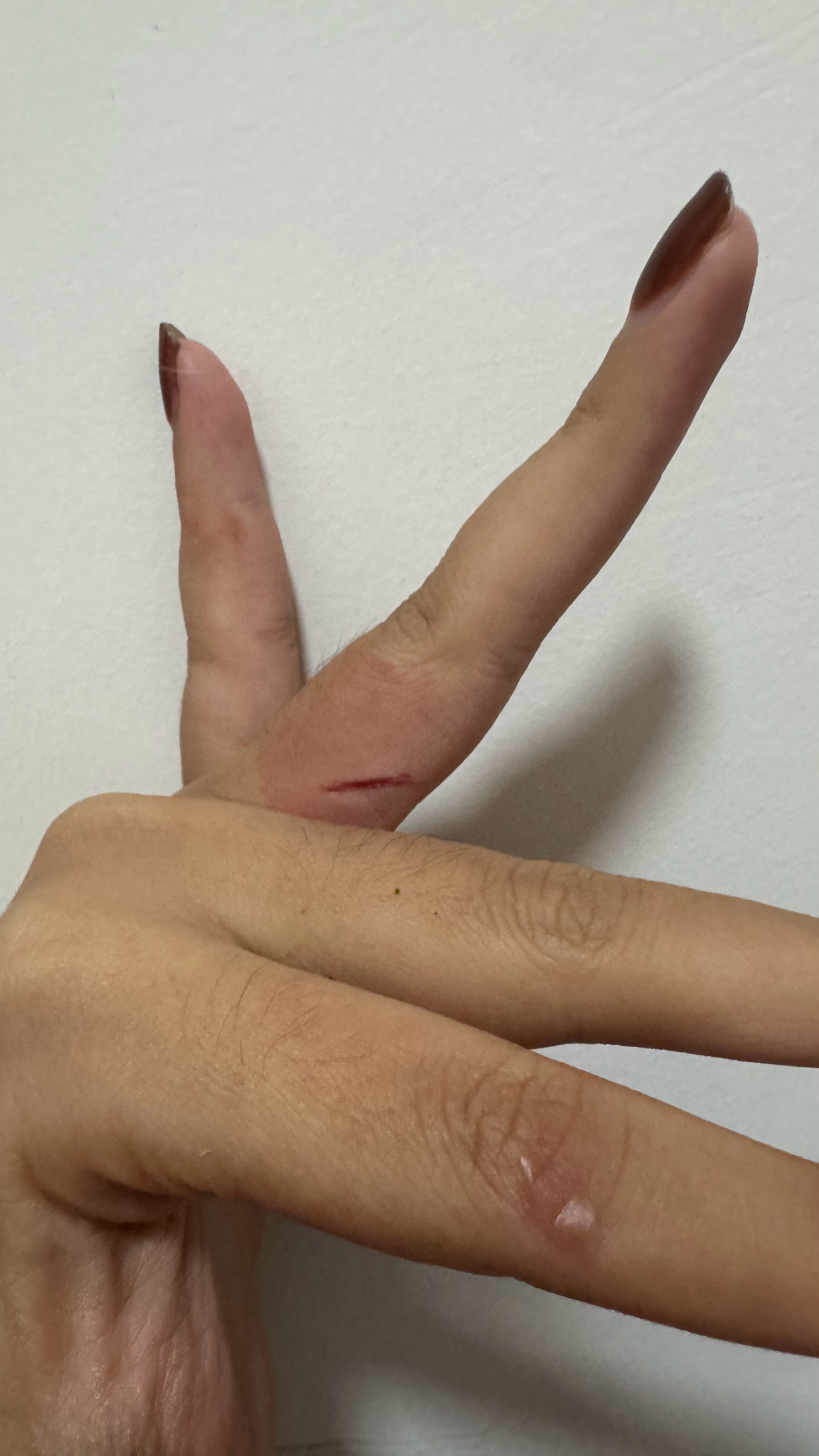 去个牛油果🥑核能给我自己手上来这么一刀我对自己太“好”了你们都想不到这位置是怎