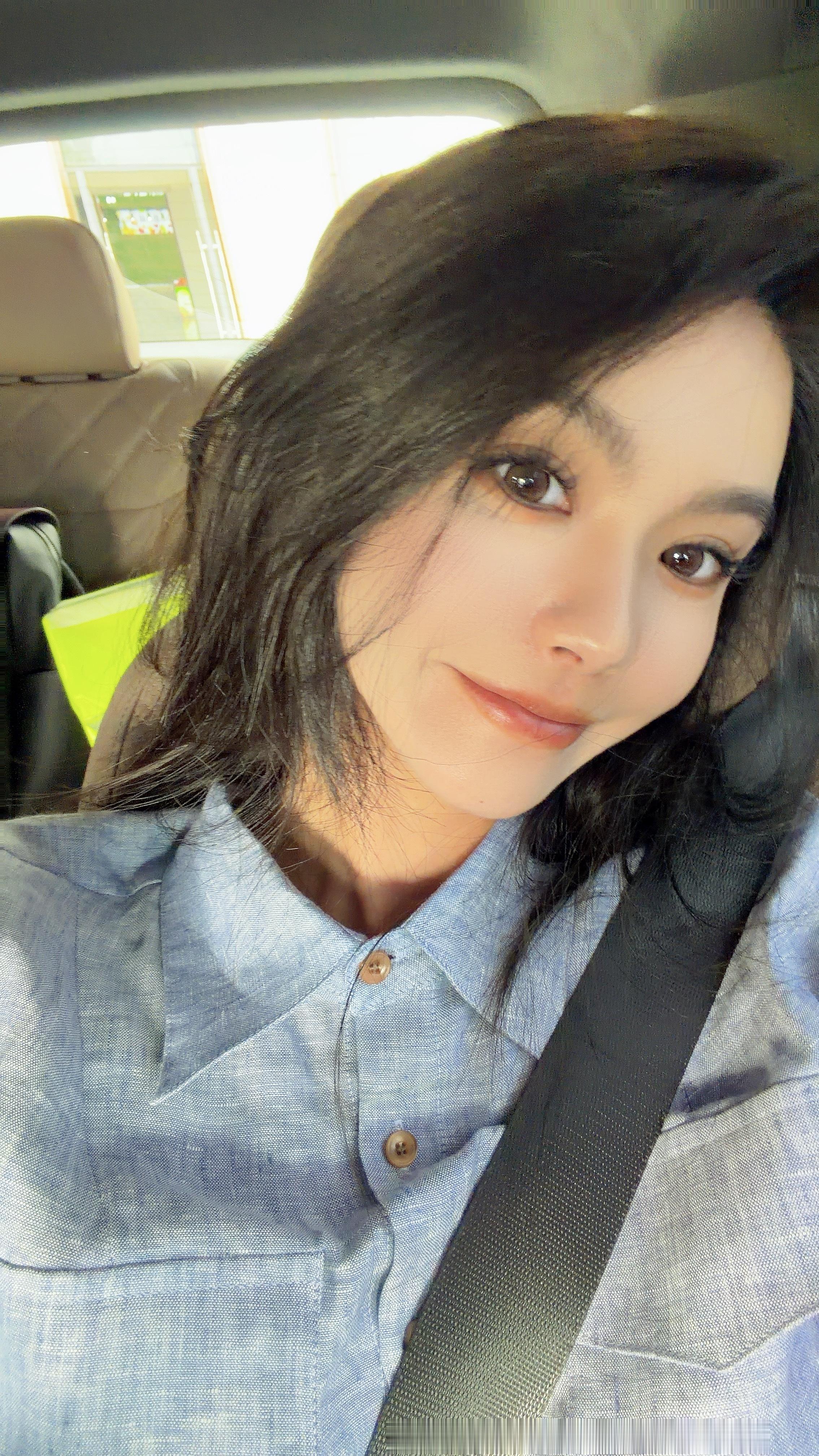 毛发太旺盛，有什么说法？ 合肥