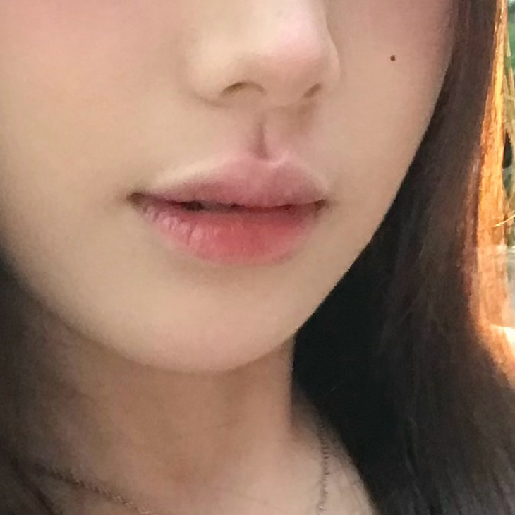 我竟然拥有如此之完美的人中窝 ​​​