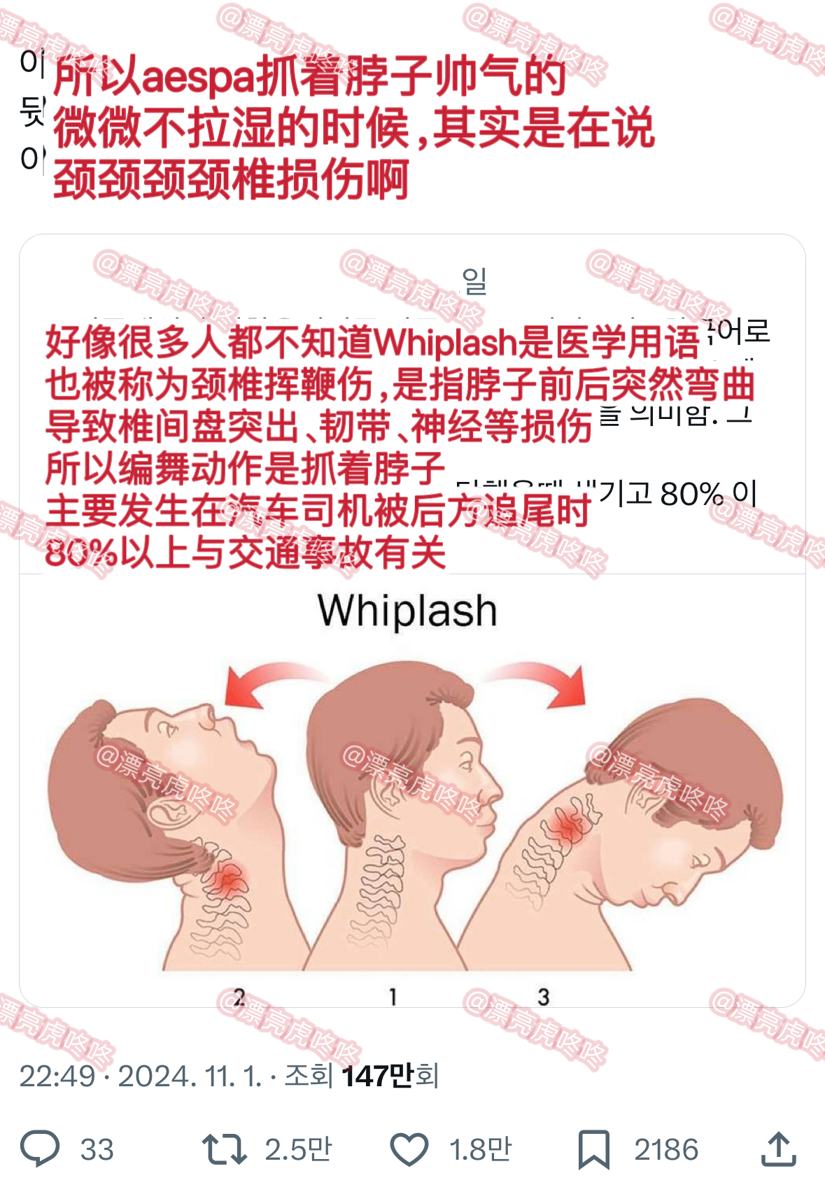 【twi】Whiplash的意思 ​​​
