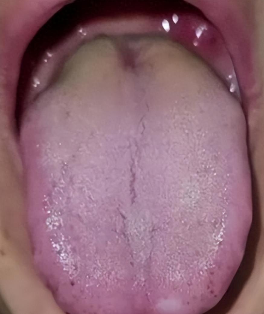 舌苔黄腻，舌面还有黑点？想要调理得按顺序来！

先看患者问题：房事有心无力，宗筋