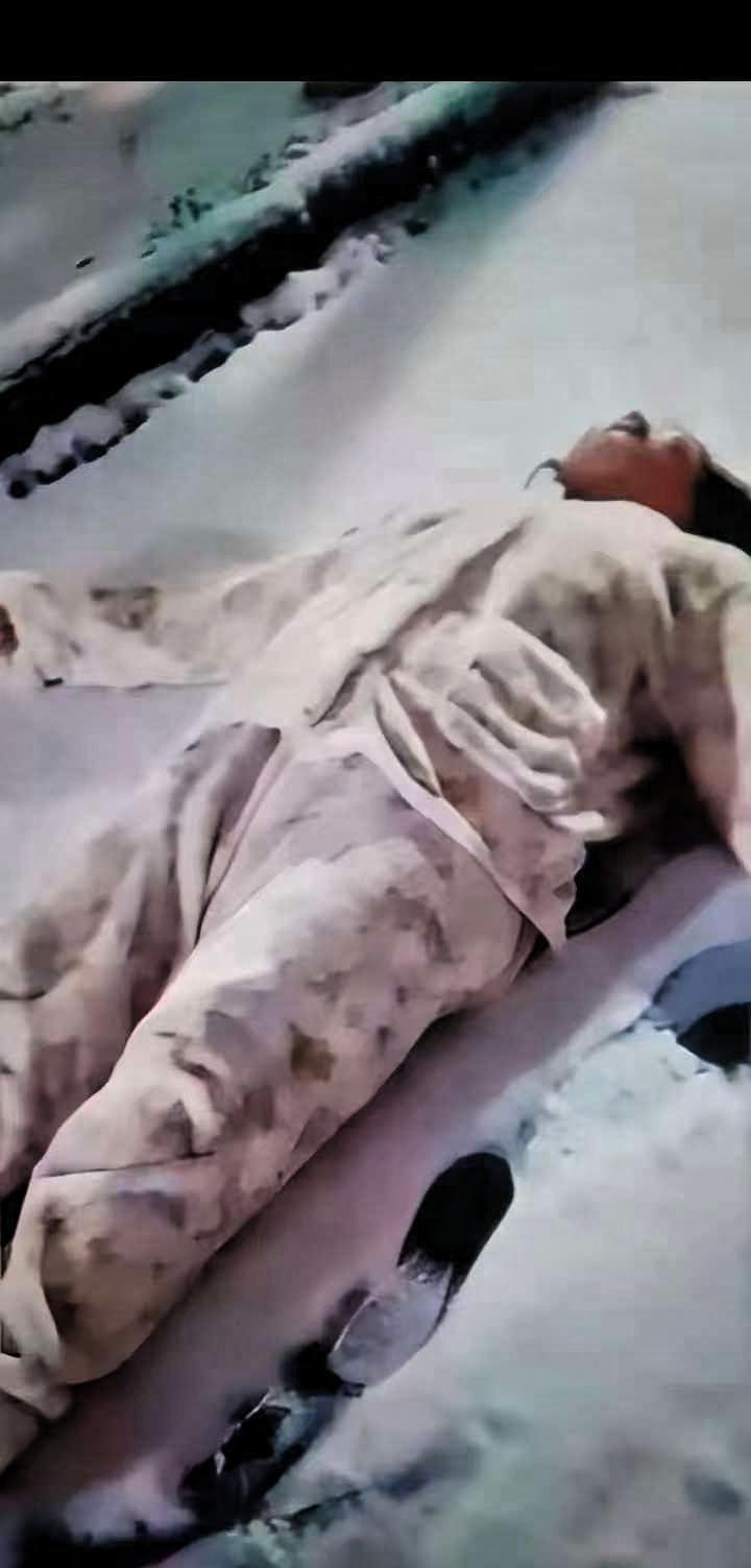 痛心！太快了，妻子下雪出去溜达玩，突然不小心后脑勺着地，当时摔的人不会吭声了
