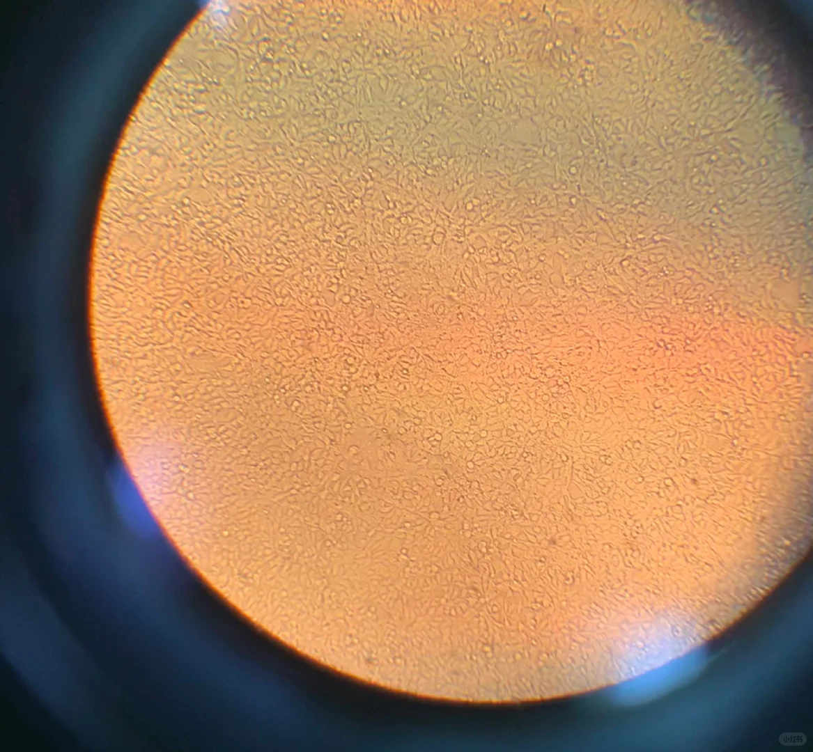 这细胞密度应该是100%了